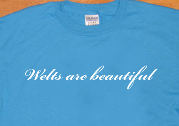 WELTS ARE BEAUTIFUL T SHIRT